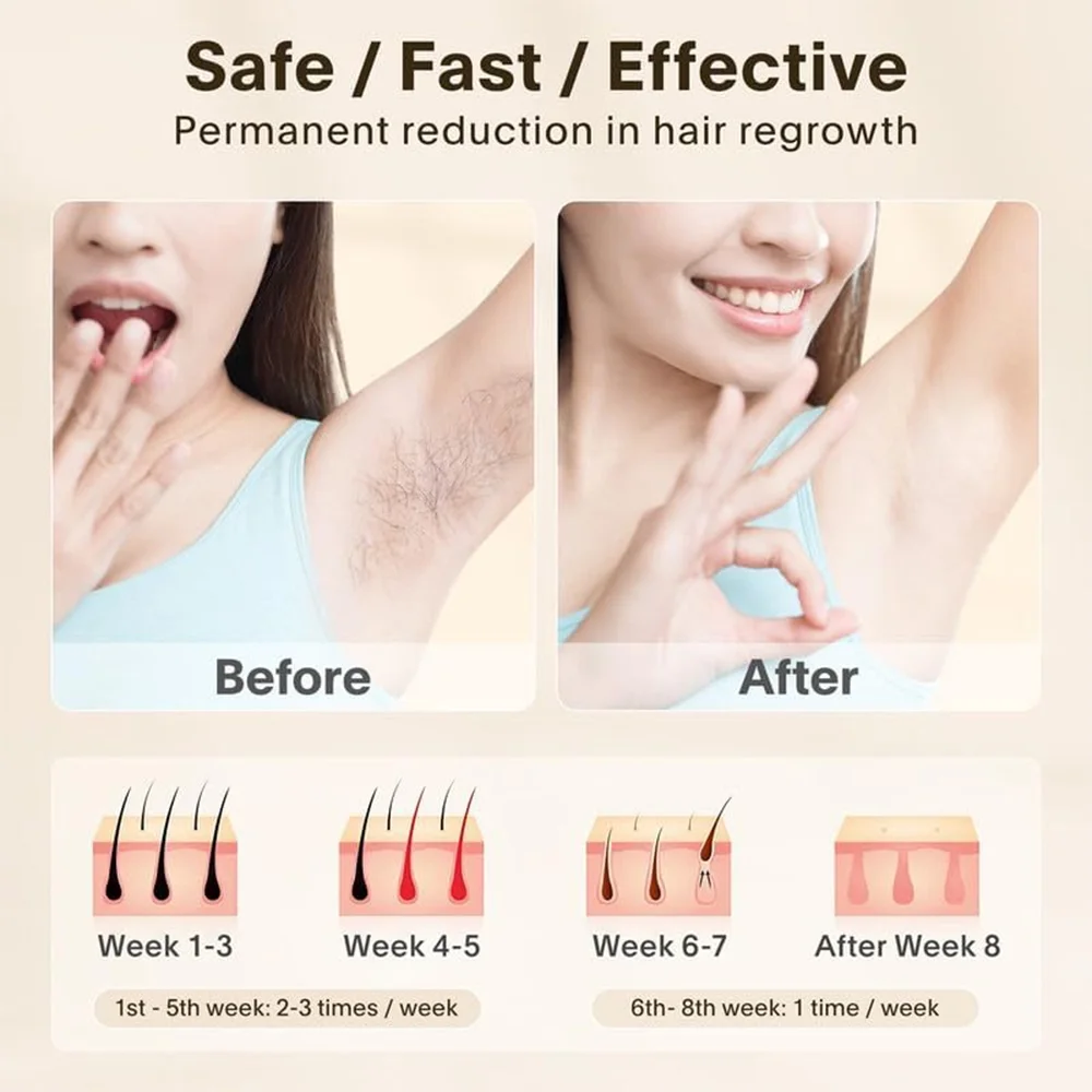 Intense Pulsed Light Hair Removal for Women and Men, Hair Removal Device for Body,Best Gift - Image 5