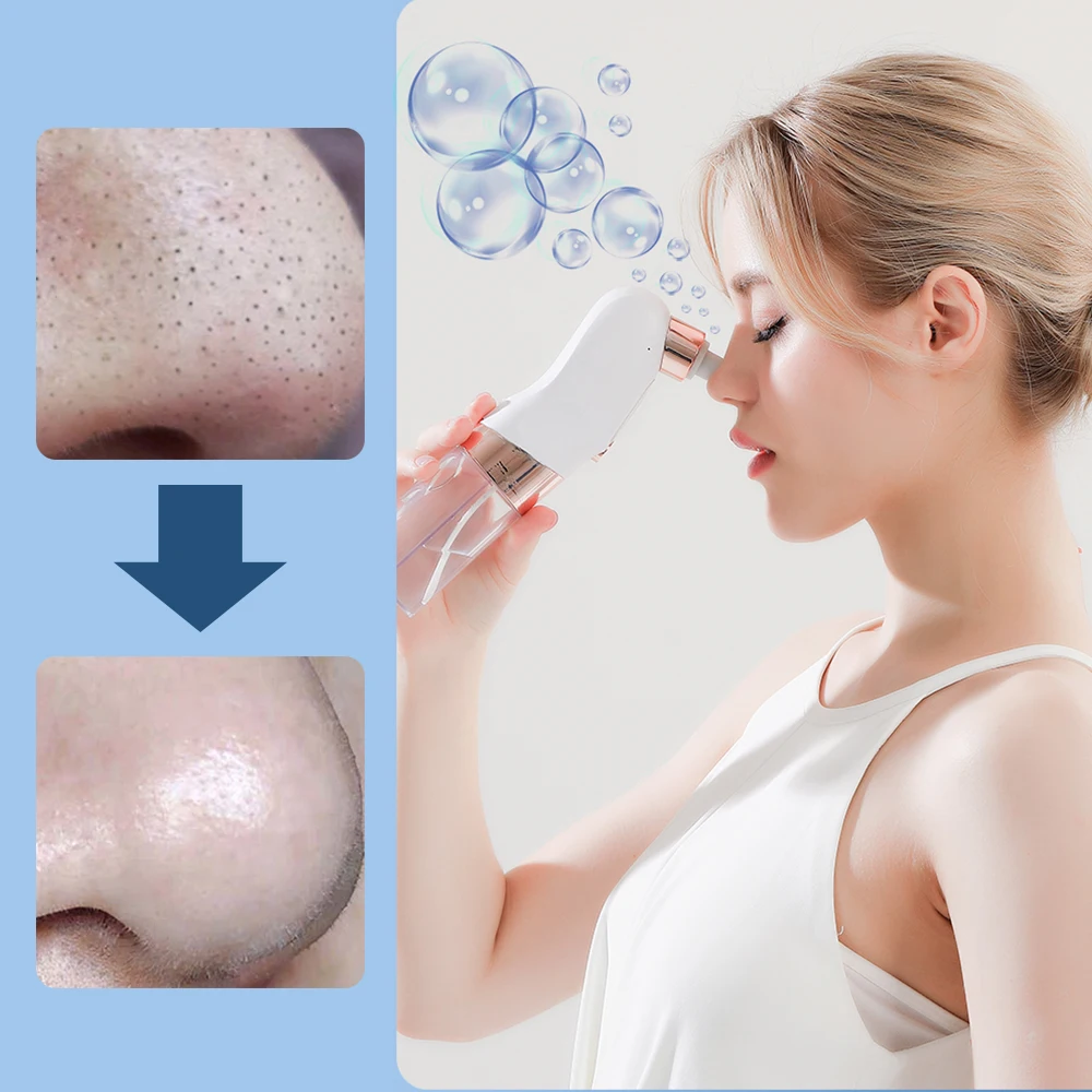 Electric Bubble Blackhead Remover - Skincare & Beauty