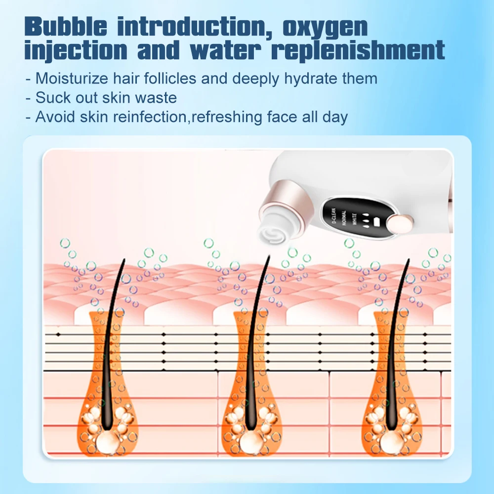 Electric Bubble Blackhead Remover - Skincare & Beauty